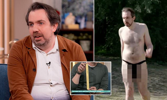Man with Britain’s largest pen!s reveals why he won’t get size reduction surgery