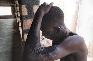 Adamawa: Lady pours very hot cooking oil on man over N100 in Adamawa