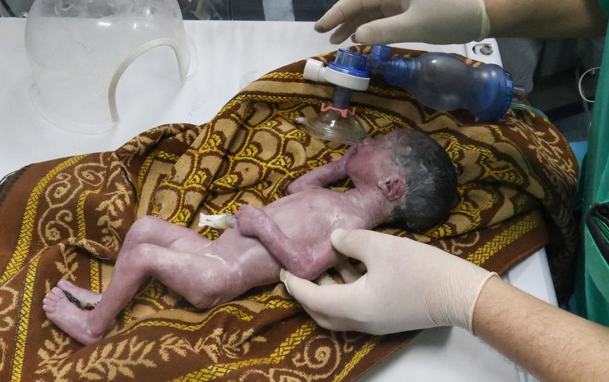 1. Gaza baby girl saved from dying mother’s womb after Israeli airstrike dies just days later