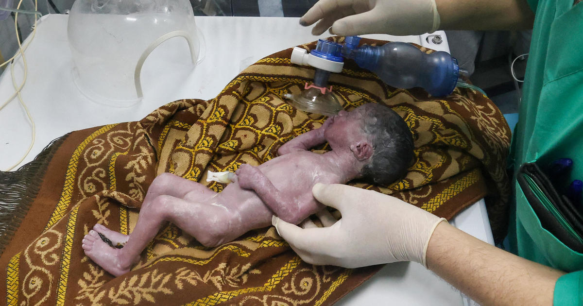 Gaza baby girl saved from dying mother’s womb after Israeli airstrike dies just days later